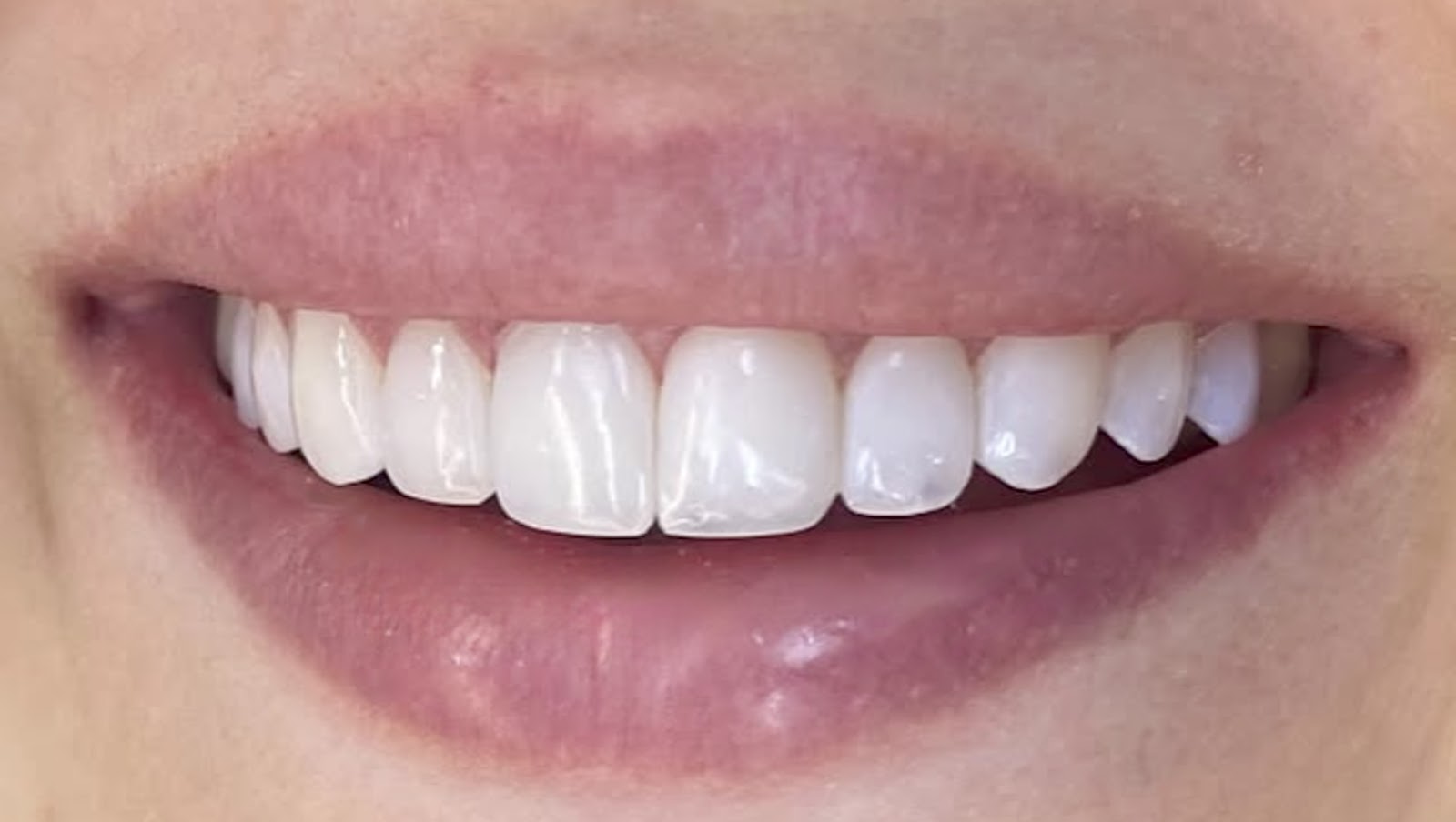 Anaheim Smile Center