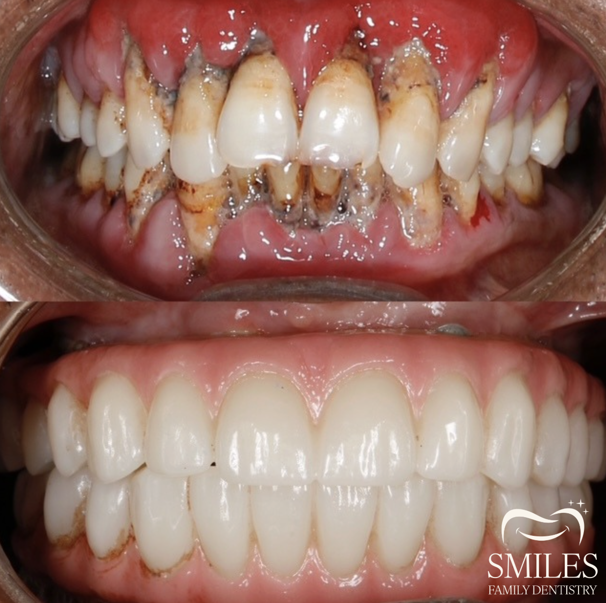 Brunswick Smiles Family Dentistry | Implant, Oral Surgery, and Cosmetic Dentist in South Brunswick