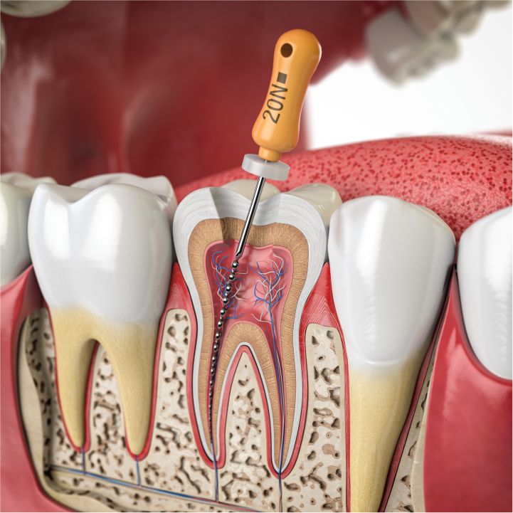Dental Implant and Orthodontics center of West Covina