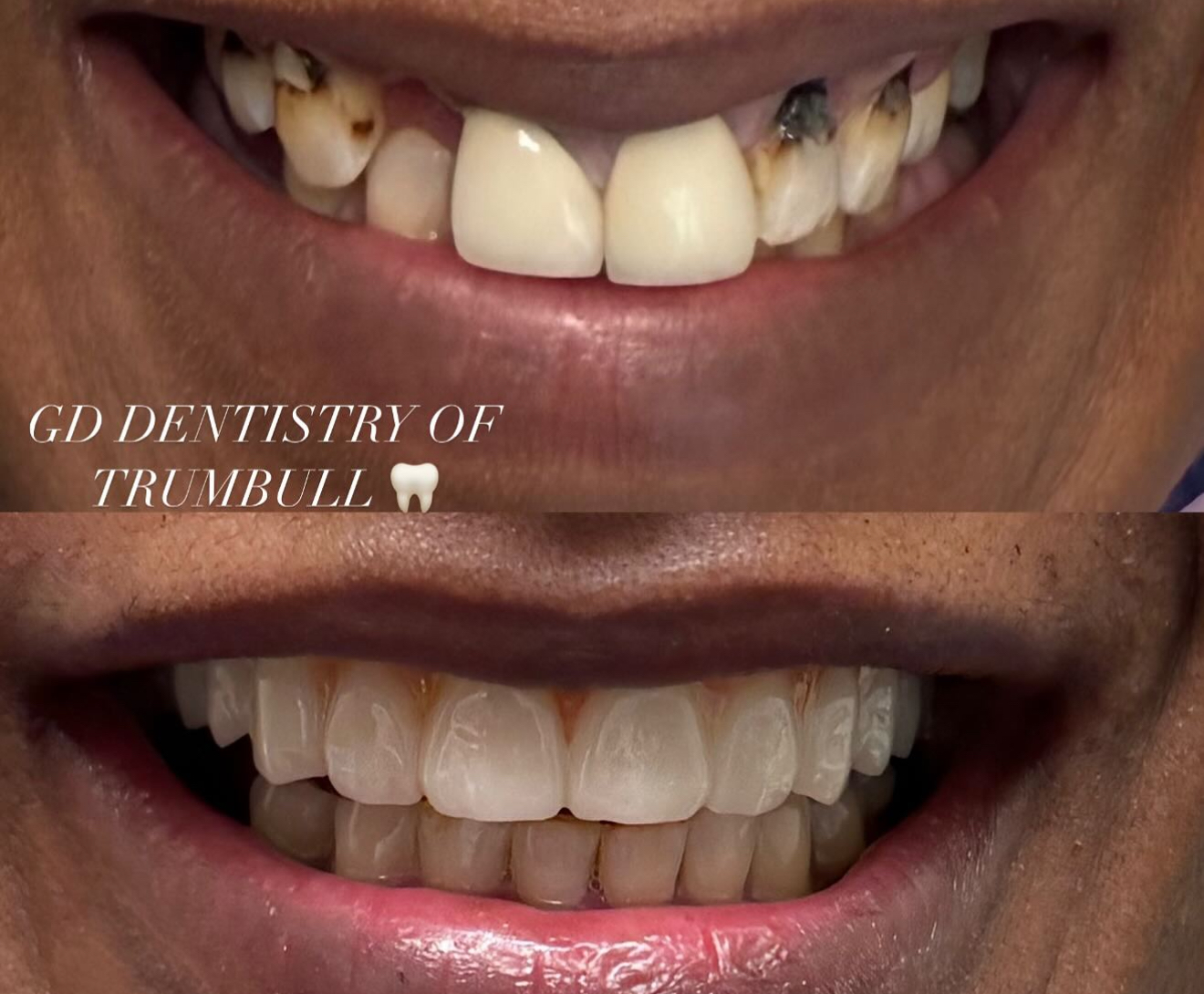 GD Dentistry of Trumbull