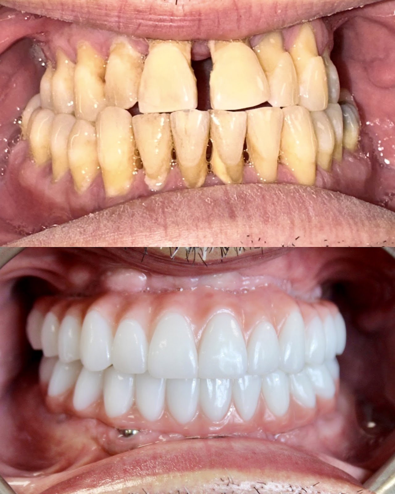 Signature Smiles Dental Implants and Cosmetic Dentistry